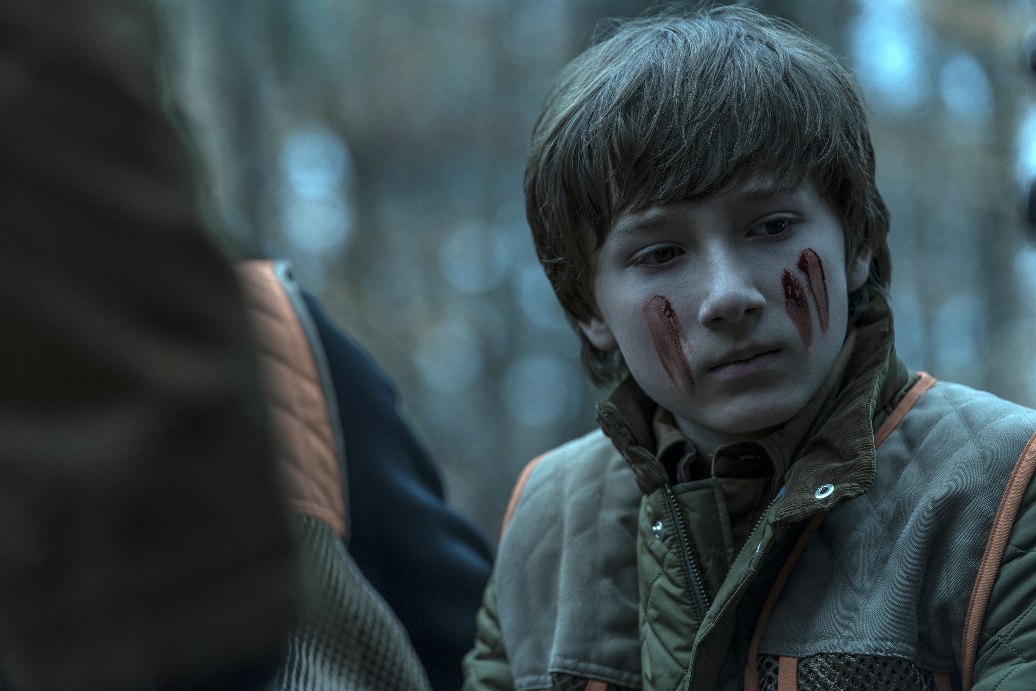 Boy with blood on his face in Ozark HD Wallpaper