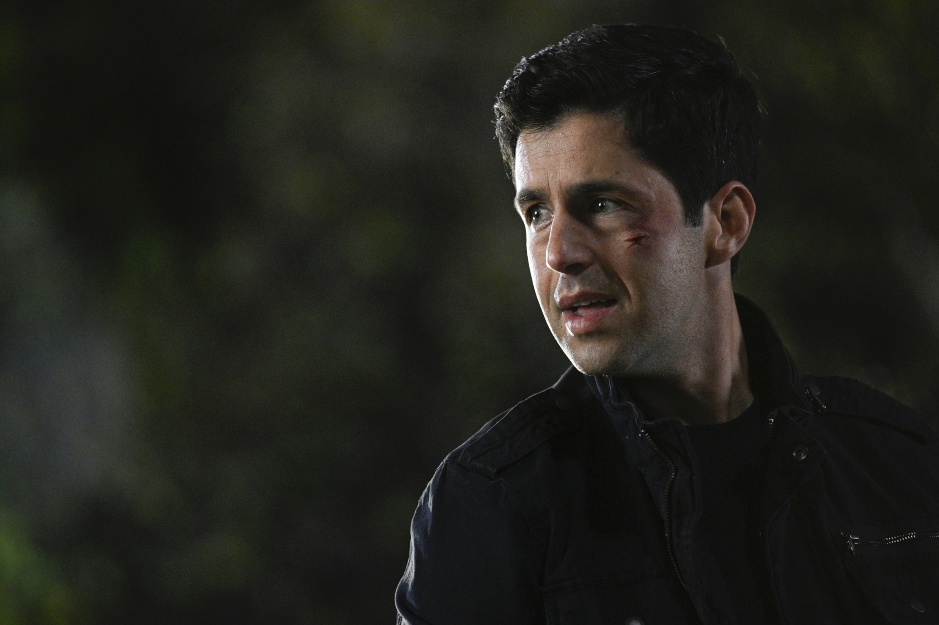 Josh Peck with facial scratches in Turner and Hooch HD Wallpaper