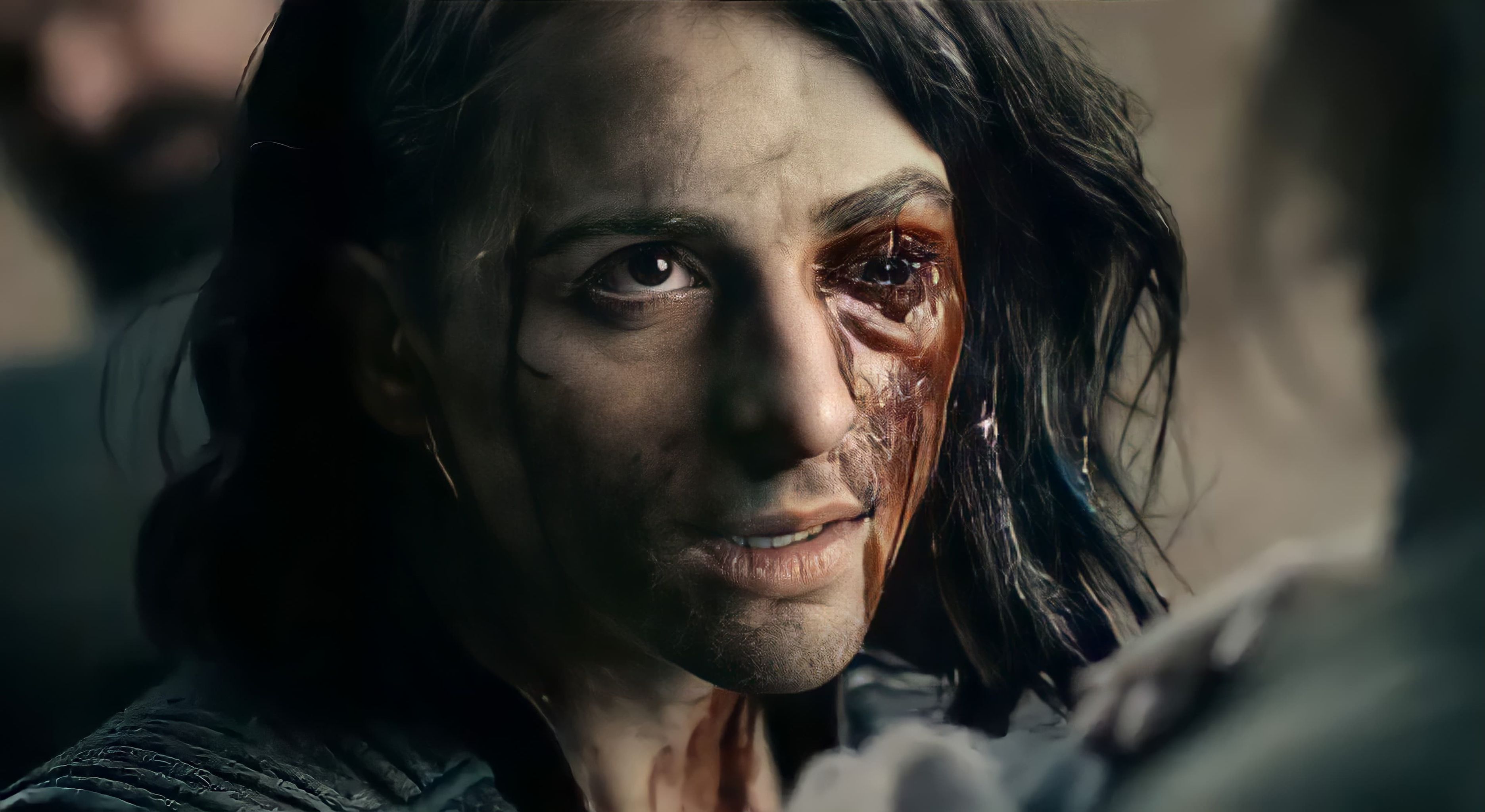 Stormfront from The Boys with injured face HD Wallpaper