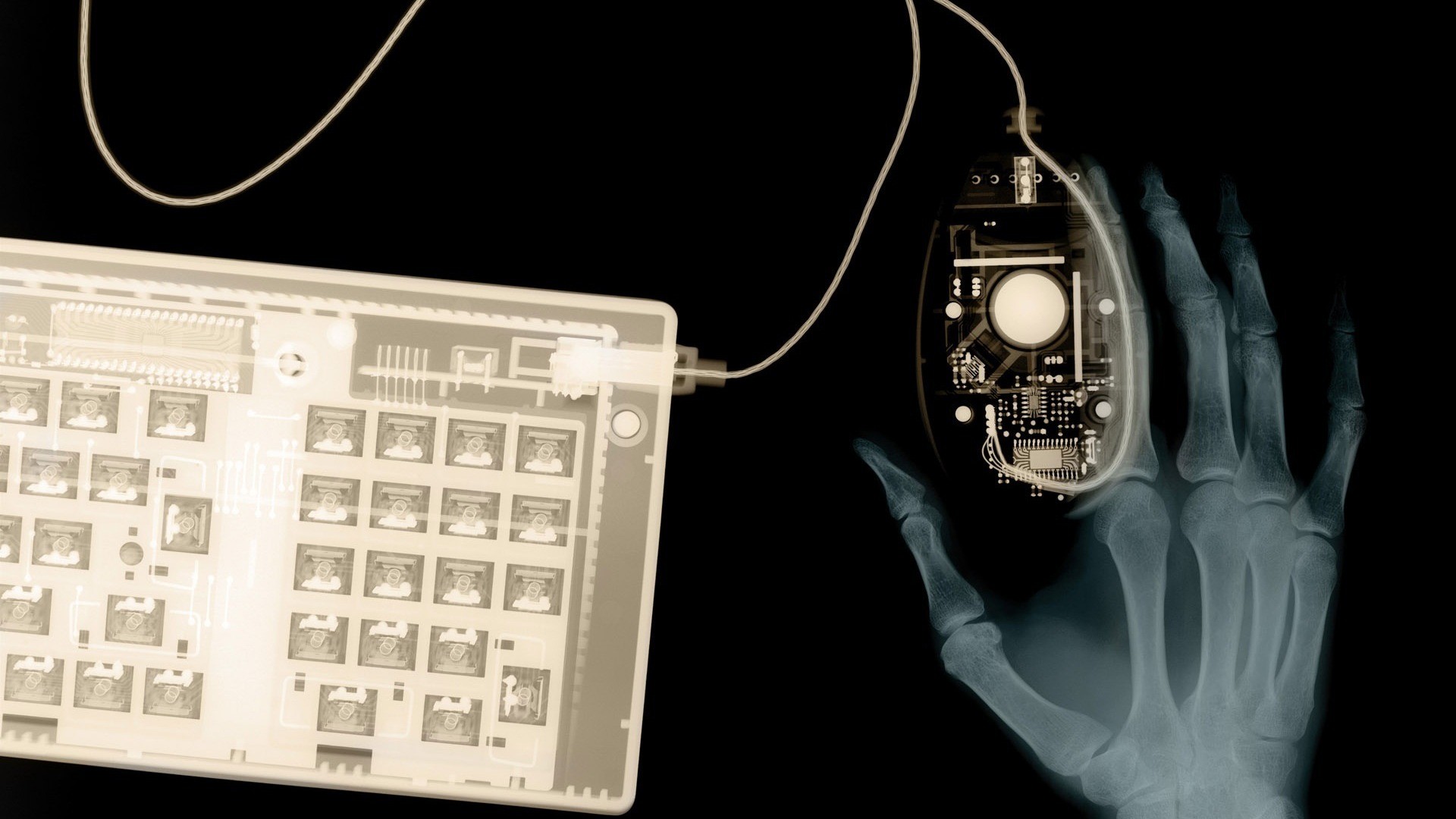 X-ray of hand using keyboard and mouse HD Wallpaper