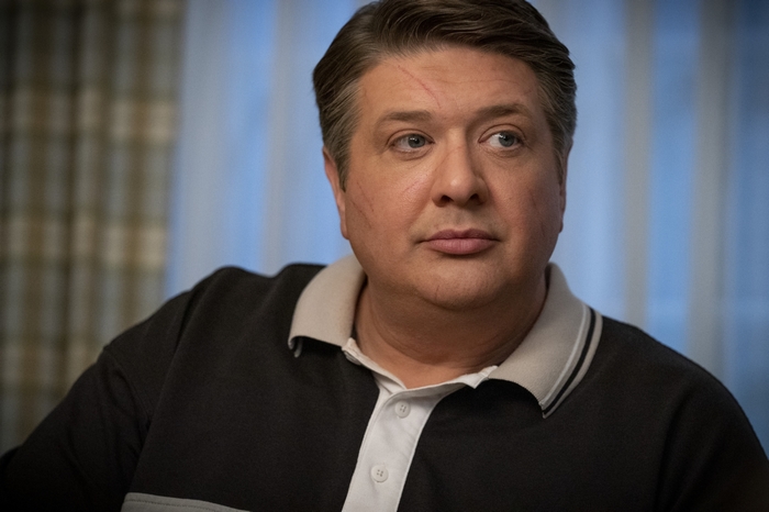 Lance Barber as George Cooper with facial scars