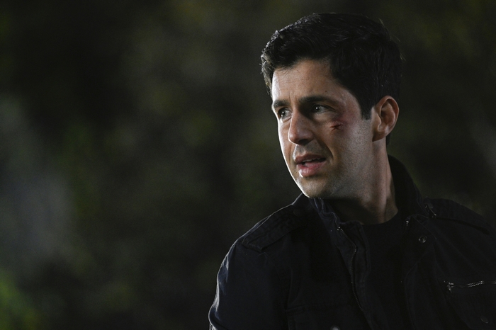 Josh Peck with facial scratches in Turner and Hooch