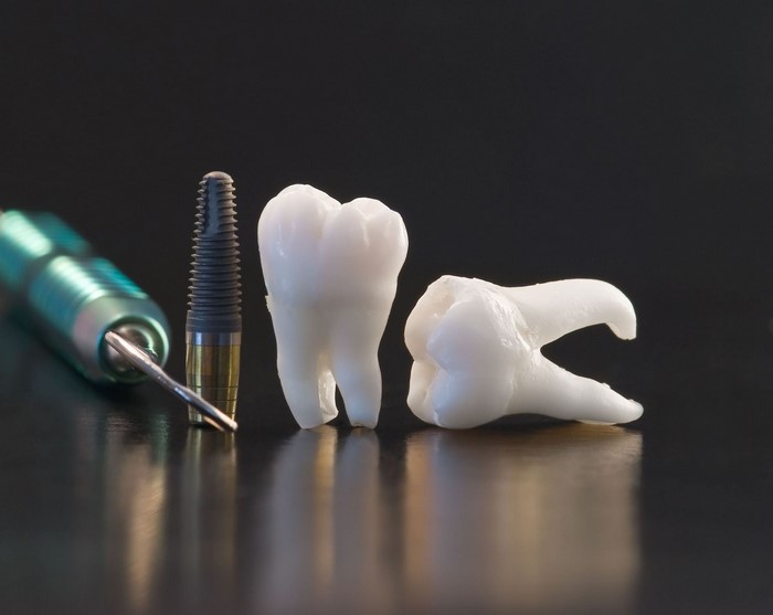 Dental implant, drill, and teeth on black background