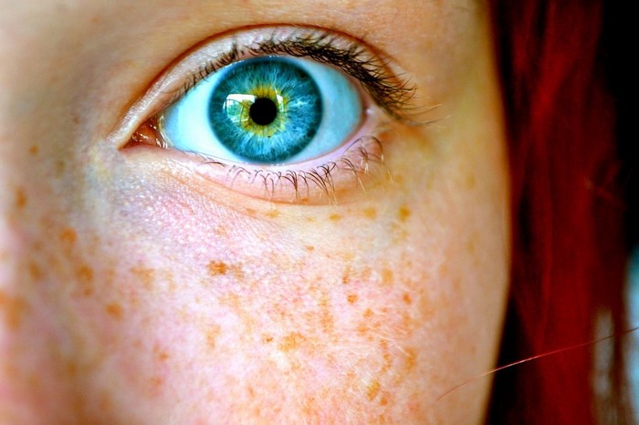 Close-up of a woman's blue eye with freckles