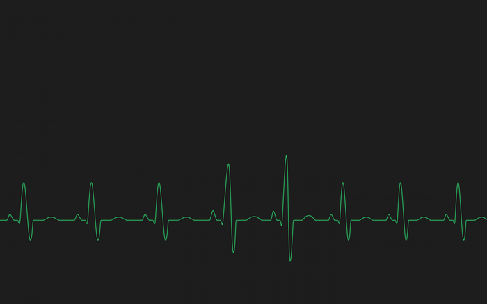 Green electrocardiogram line on black background