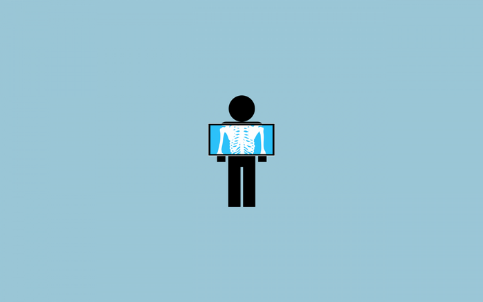 Minimalist illustration of a person holding an X-ray