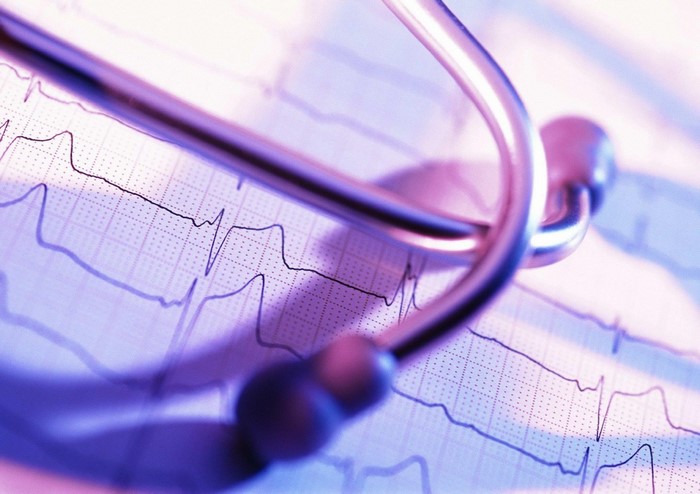 Stethoscope on electrocardiogram paper