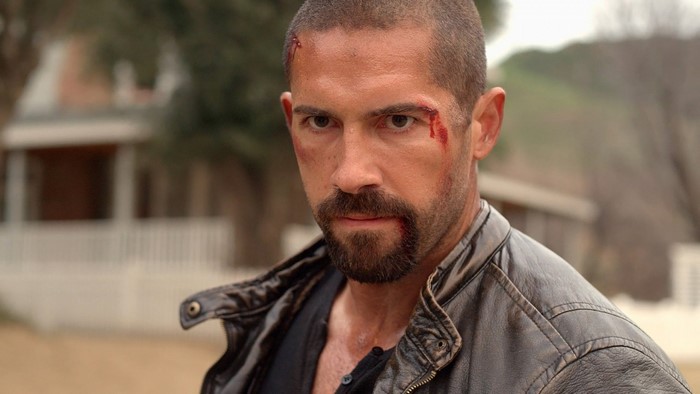 Scott Adkins with facial injuries