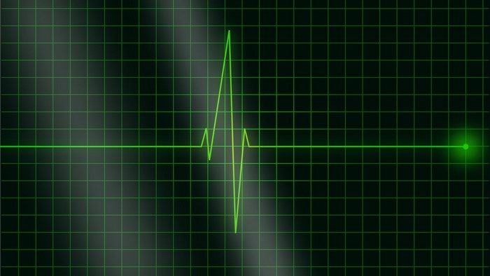 Pulse line on a grid