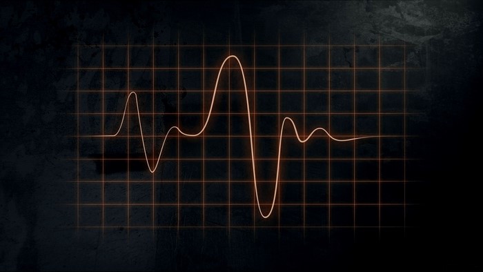 Orange pulse line on a grid