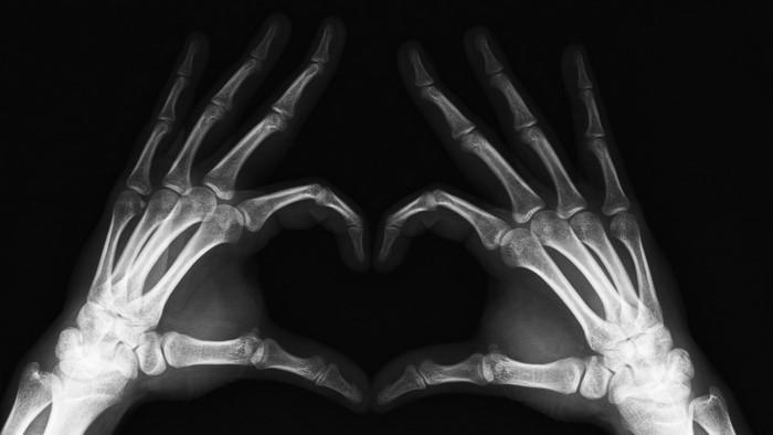 X-ray of two hands forming a heart shape