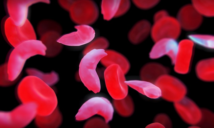 Sickle Cells and Red Blood Cells 4K