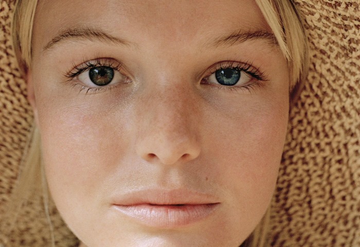 Kate Bosworth with Heterochromia