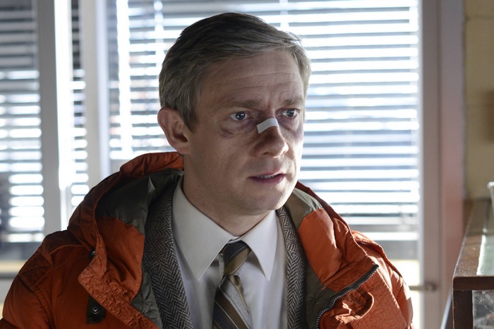 Martin Freeman with bruised face and bandaged nose