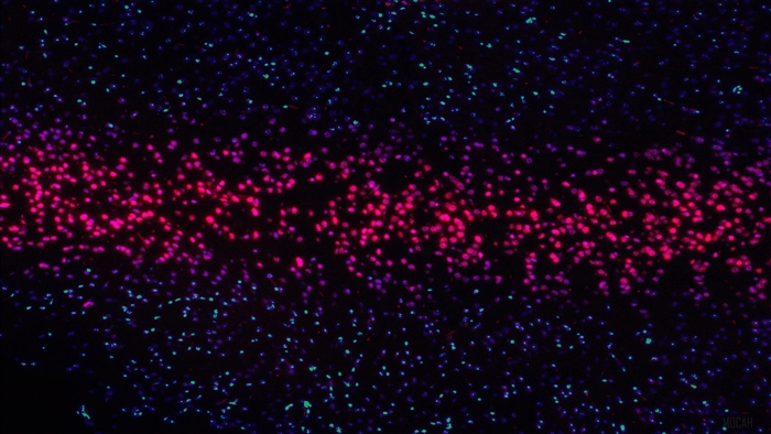 Microscopic view of cells with red and blue fluorescence