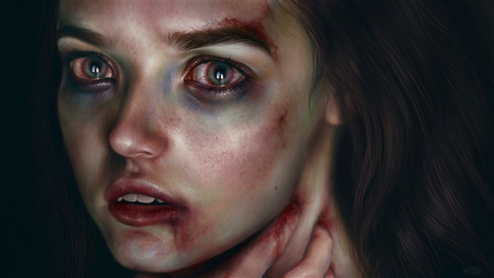 Injured Girl Artistic