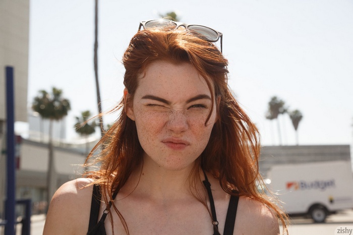 Sabrina Lynn with freckles and sunglasses