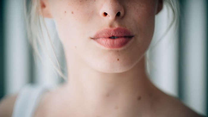 Close-up of a woman's face with freckles and moles