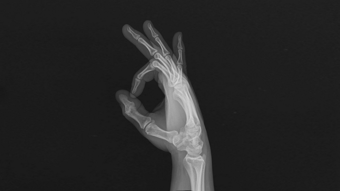 X-ray of a hand making an OK sign