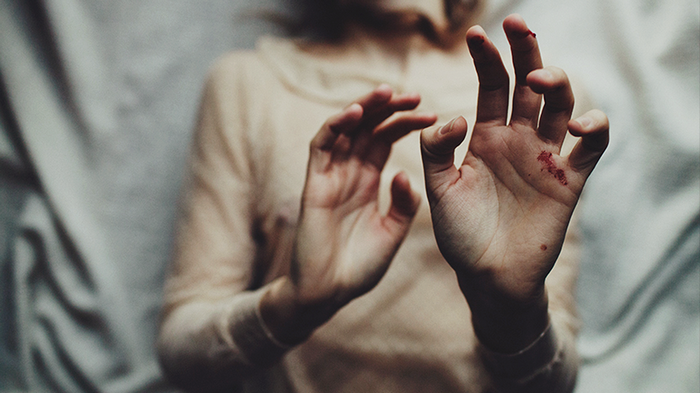 Woman's hands with bloodied wounds