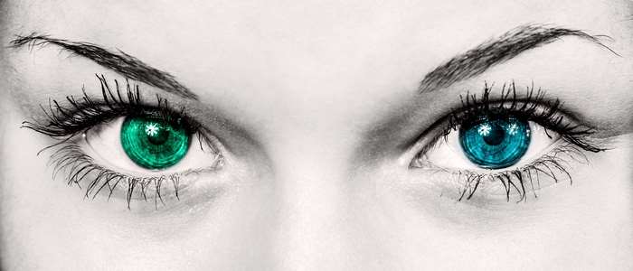 Woman's eyes with different colored irises