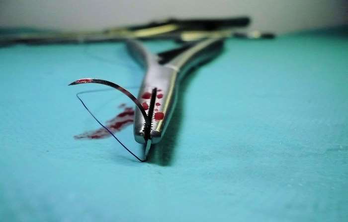 Surgical needle with thread and blood on forceps