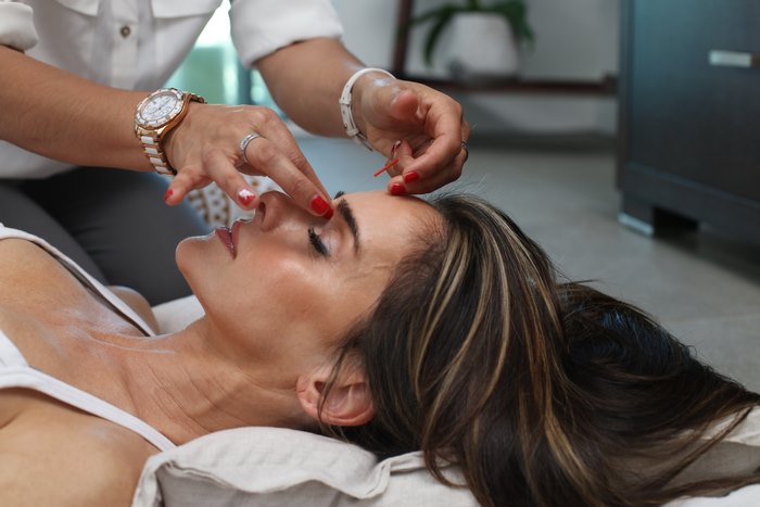 Acupuncturist performing facial acupuncture on a woman