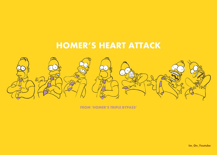 Homer Simpson's Heart Attack from Homer's Triple Bypass