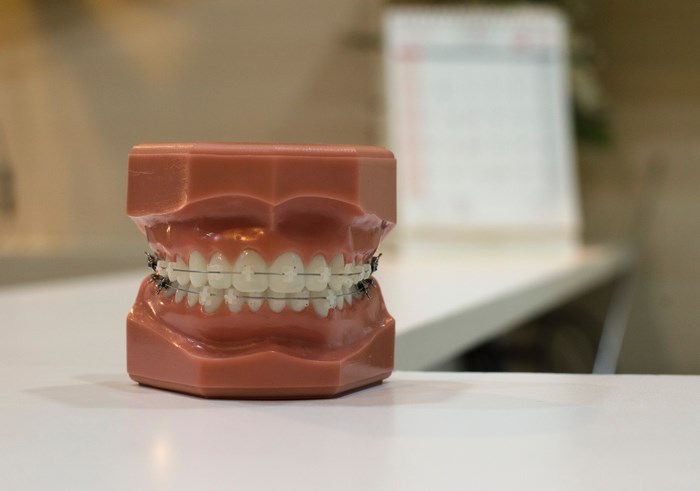 Dental model with braces on teeth