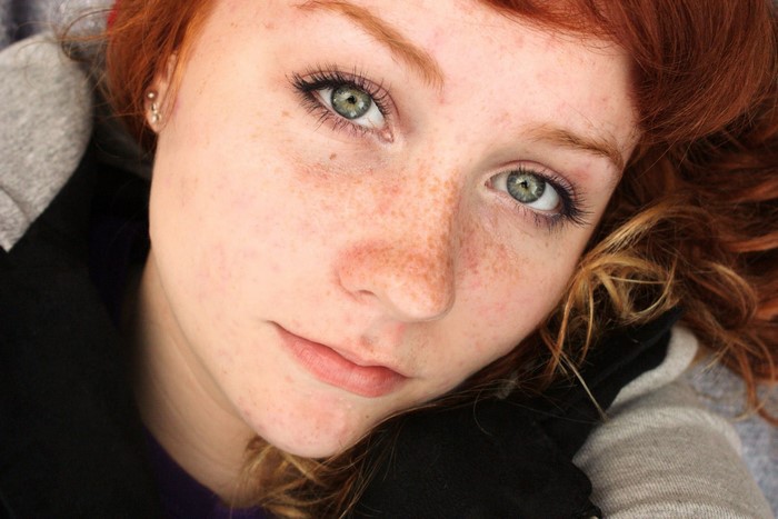 Young woman with red hair and freckles