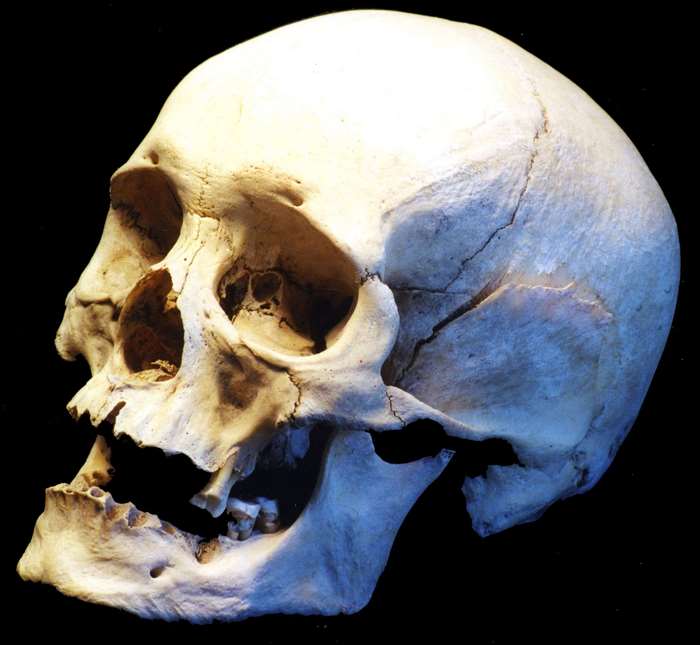 Side view of a human skull