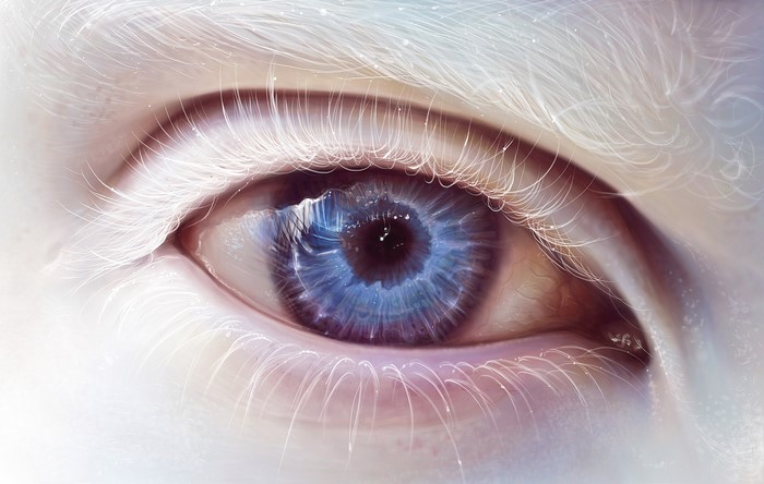 Close-up of an albino eye with blue iris
