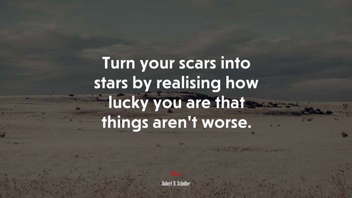 Turn your scars into stars by realising how lucky you are that things aren’t worse. | Robert H. Schuller quote