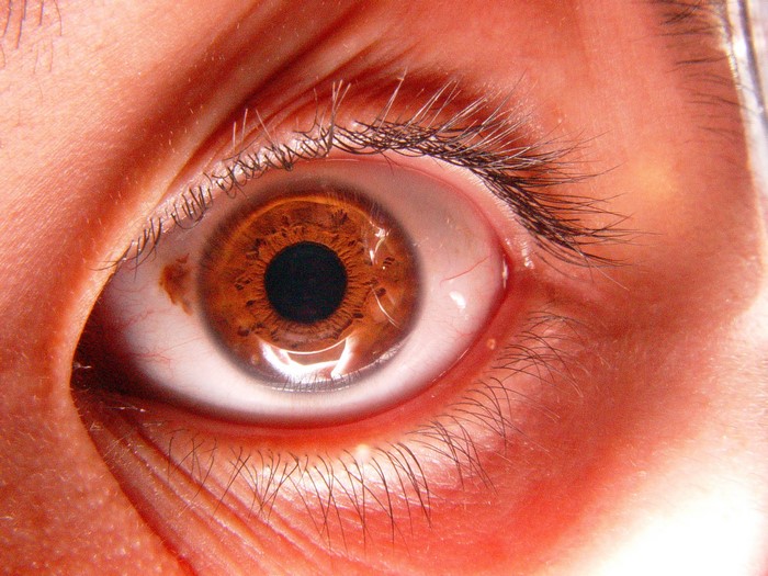 Close-up of a human eye