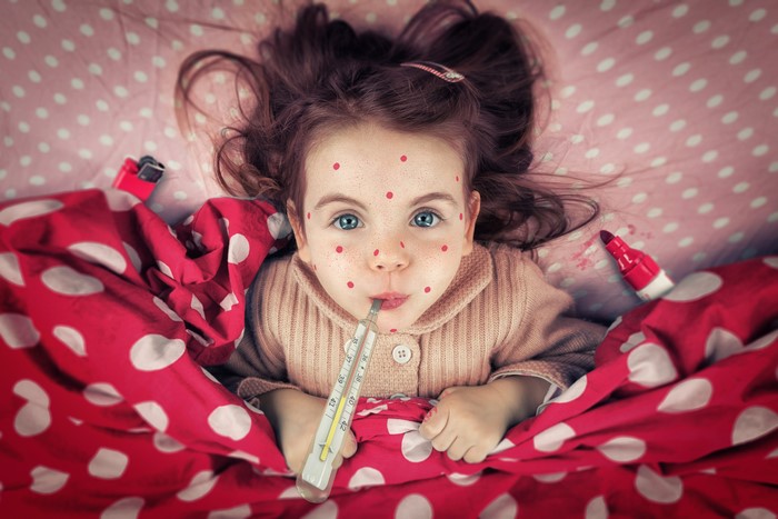 Girl with chickenpox and thermometer
