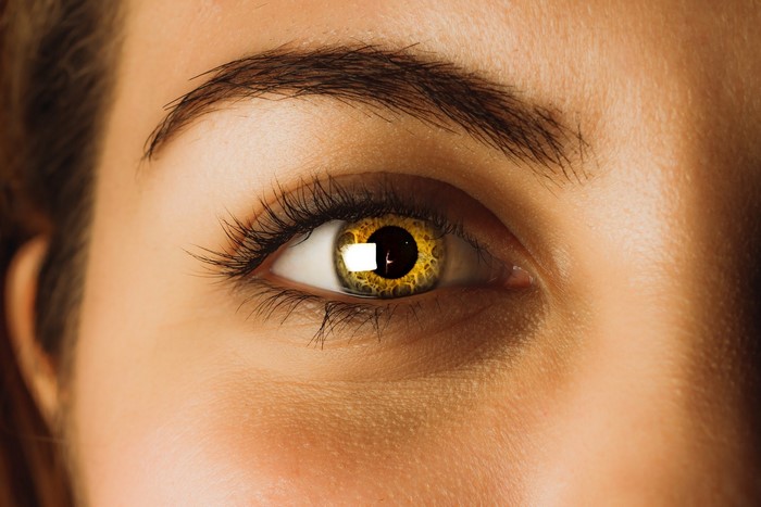 Close-up of a woman's eye with yellow iris