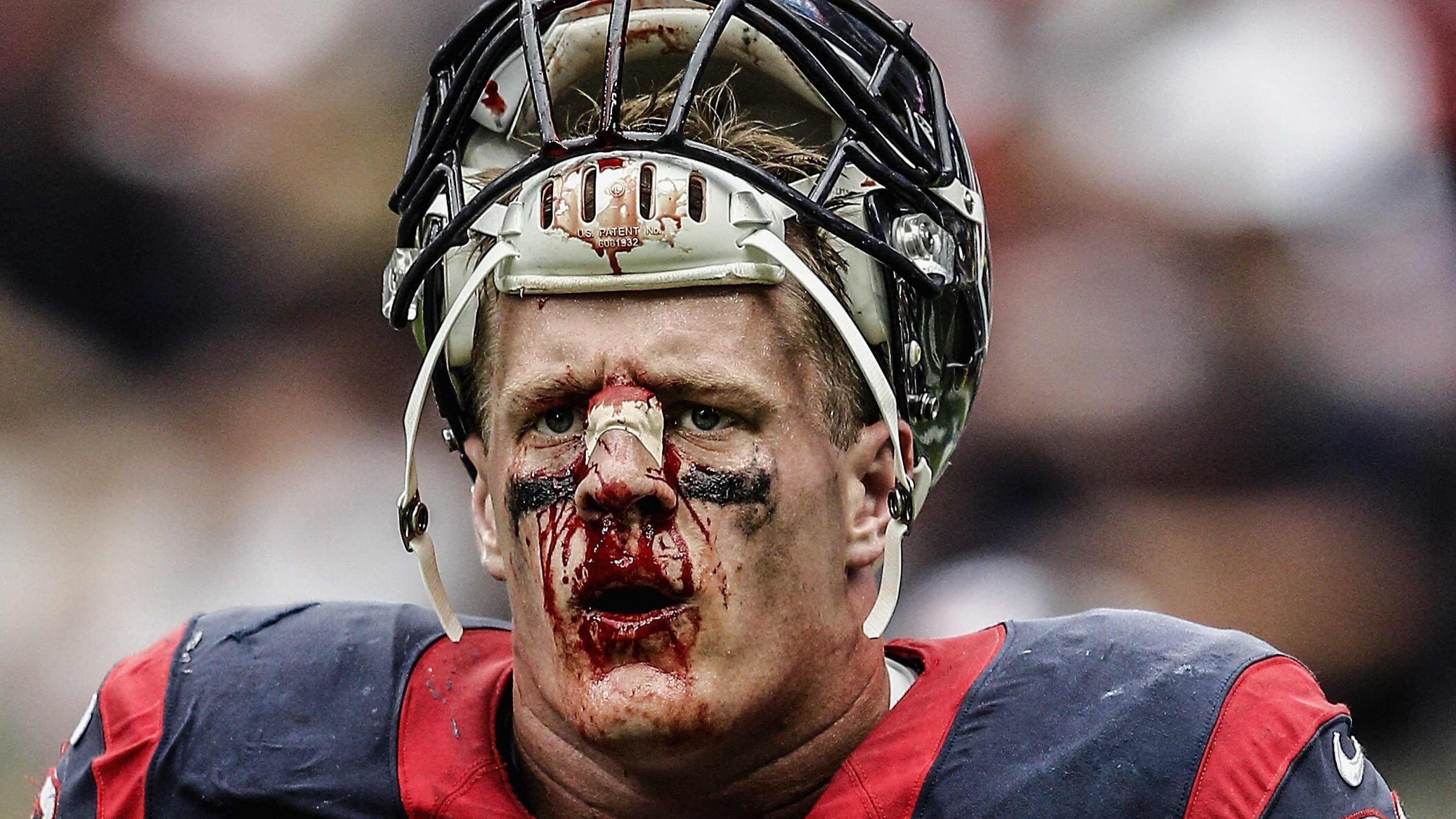 J.J. Watt with bloody face HD Wallpaper
