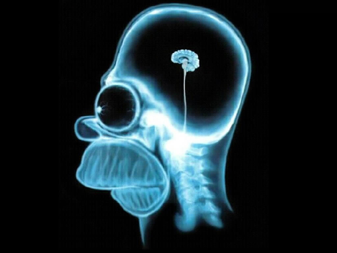 Homer Simpson X-ray brain HD Wallpaper