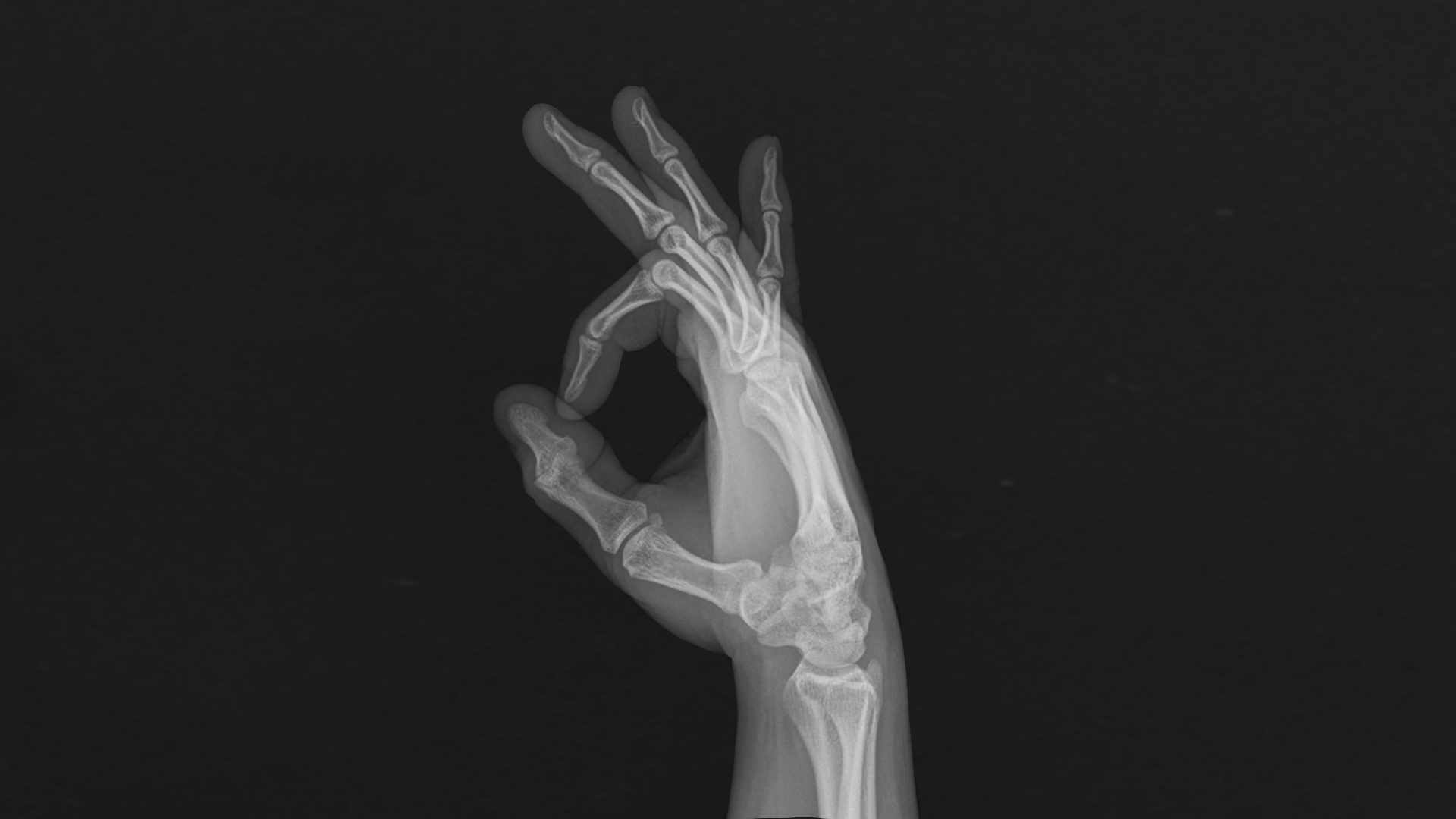 X-ray of a hand making an OK sign HD Wallpaper